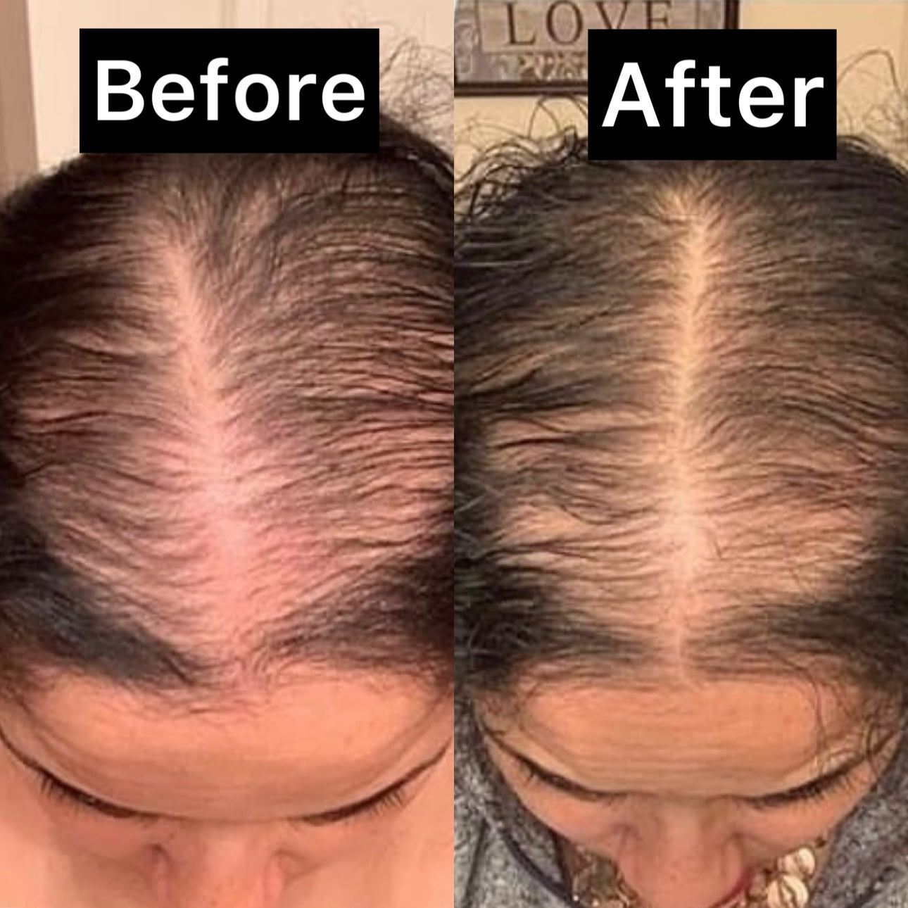 Hair Therapy Growth Drops 2oz